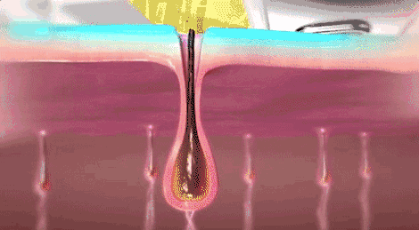 5.gif